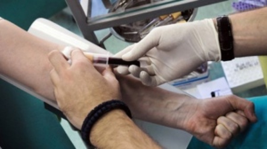 Медики рекомендуют сдать анализ крови на гепатит С